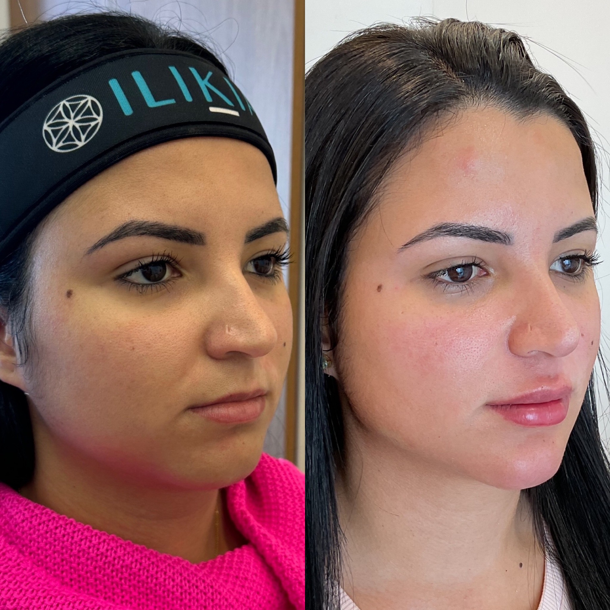 Resultado2-clinica-rica